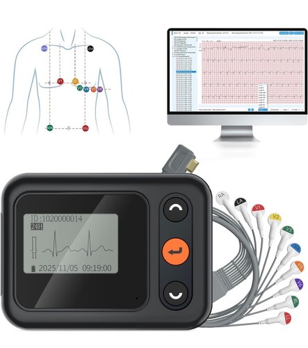 Checkme aktualisiertes ekg - checkme,
